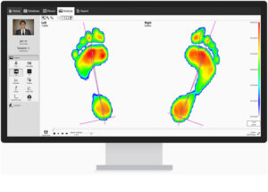 rs-foot-scan2