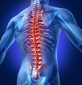 Inflammation_of_the_spinal_cord