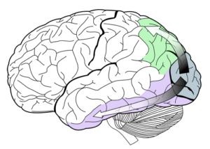 Cortical Blindness