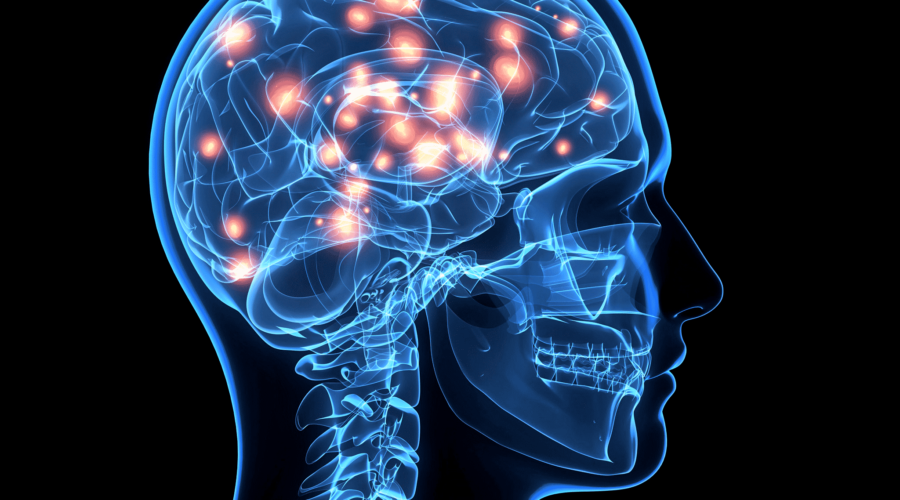 National Brain Injury Awareness Month